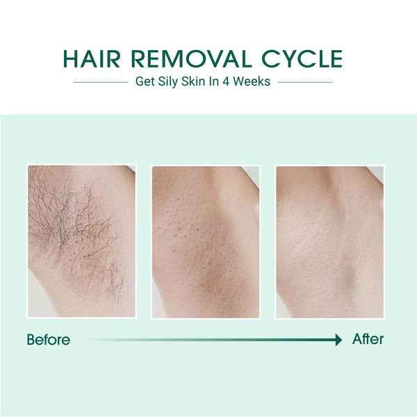 Laser IPL Hair Removal a9f1c54b-1f3c-4125-a657-0c27c9e21c8b